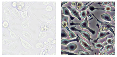 Cells under bright field and phase contrast observation