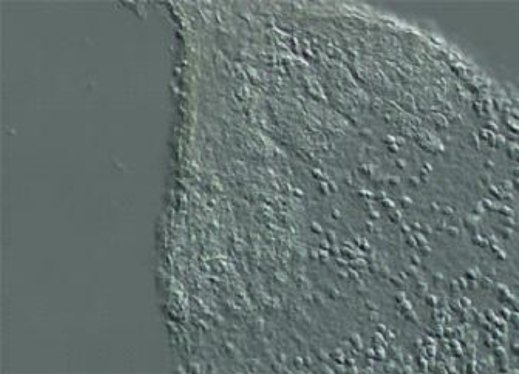 Differential interference contrast DIC