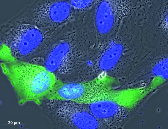 Phase contrast observation and fluorescence imaging superposition