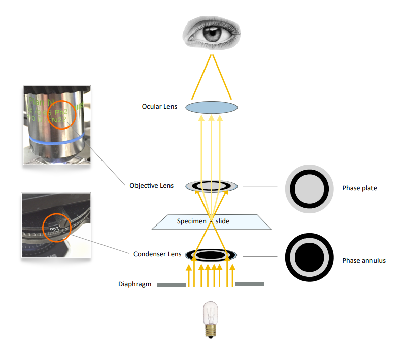 Phase contrast