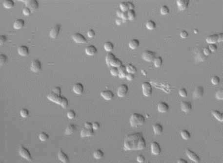 PlasDIC imaging effect