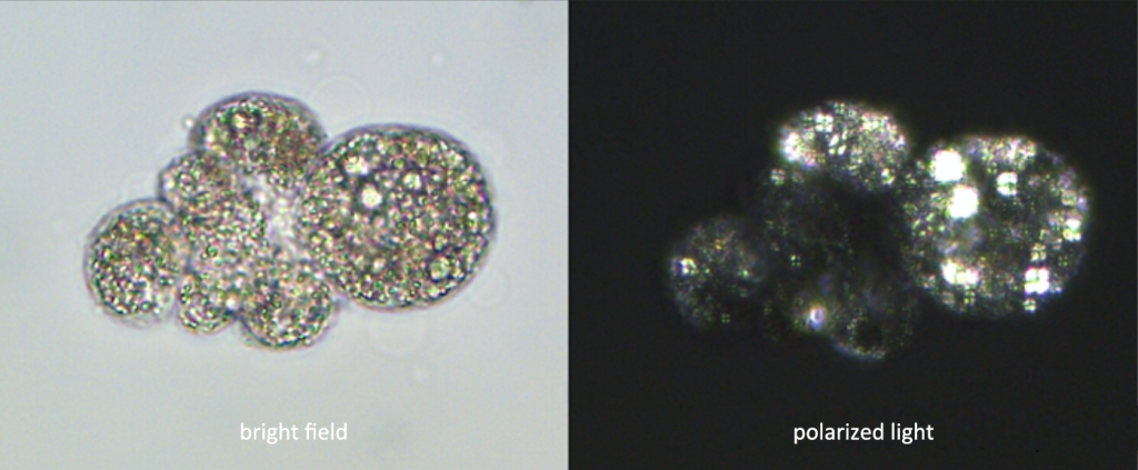 bright field and polarized light