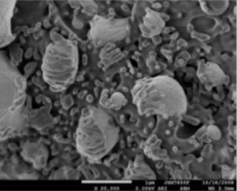 secondary electron image