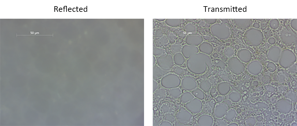 Reflected and transmitted illumination of fatty liver tissue sections fixed on glass slides.
