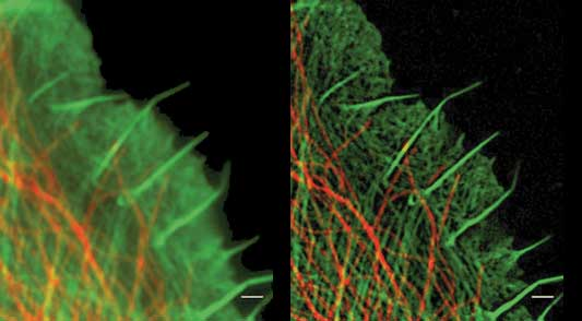 SIM super-resolution imaging (right)