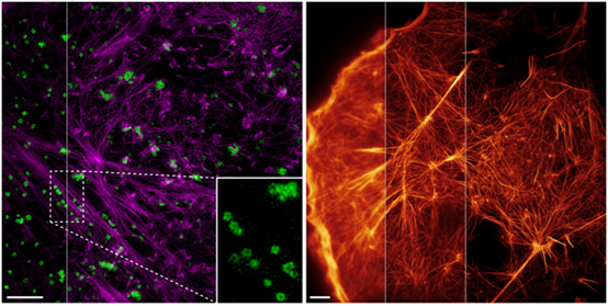 Two methods to improve the resolution of live cell microscopy imaging