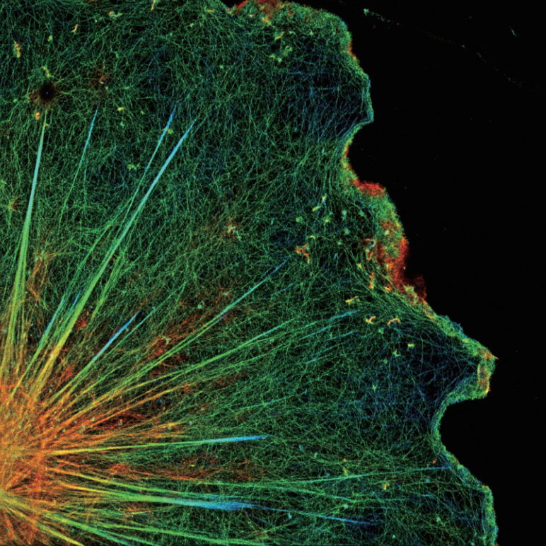 Glia in a neuronal culture