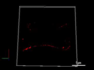 Sperm